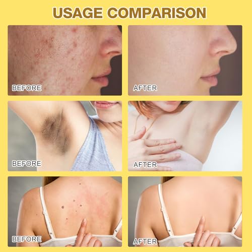 Bee Venom Treatment, New Professional Bee Venom Repair Cream,Bee Venom Moisturizing Gel, Natural Bee Venom Repair Cream, for All Skin Types (2pcs)